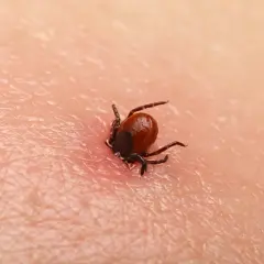 Kleszcz czarny, mały pasożyt, wgryza się w ludzką skórę, powodując zaczerwienienie.