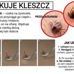 Kleszcze nie skaczą, ale spadają na ofiarę z trawy lub gałęzi. Obraz pokazuje atak kleszcza i jak go usunąć.