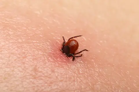 Kleszcz czarny, mały pasożyt, wgryza się w ludzką skórę, powodując zaczerwienienie.