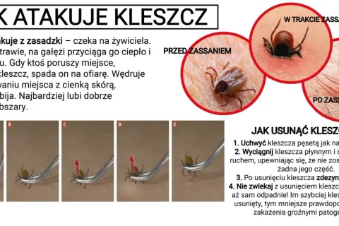 Kleszcze nie skaczą, ale spadają na ofiarę z trawy lub gałęzi. Obraz pokazuje atak kleszcza i jak go usunąć.