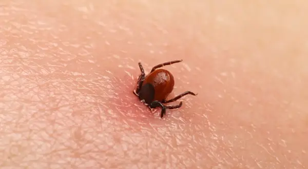 Kleszcz czarny, mały pasożyt, wgryza się w ludzką skórę, powodując zaczerwienienie.