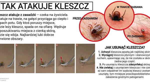 Kleszcze nie skaczą, ale spadają na ofiarę z trawy lub gałęzi. Obraz pokazuje atak kleszcza i jak go usunąć.