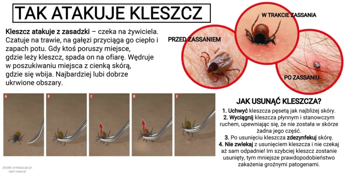 Kleszcze nie skaczą, ale spadają na ofiarę z trawy lub gałęzi. Obraz pokazuje atak kleszcza i jak go usunąć.