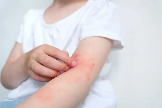 Alergia na psa - Jak rozpoznać objawy i co faktycznie pomaga?