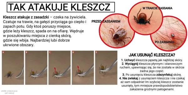 Kleszcze nie skaczą, ale spadają na ofiarę z trawy lub gałęzi. Obraz pokazuje atak kleszcza i jak go usunąć.